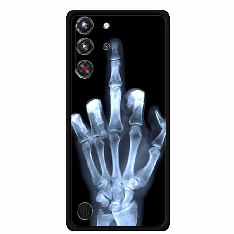 For ZTE nubia Red Magic 10 Pro - Redmagic Tablet Accessories 评论和价格